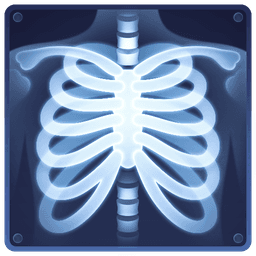 X-Ray Image Detection for Medical Implants